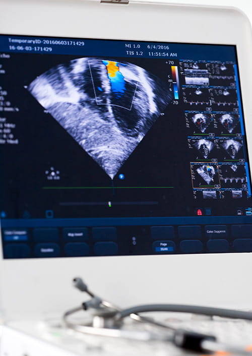 Ultrasound screen showing a cardiac color Doppler with blood flows highlighted in blue and orange; at the bottom, out of focus, part of a stethoscope resting on the console can be seen